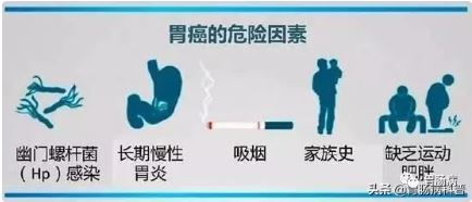 50岁的男人要注意：胃癌发病率是女性的2.4倍