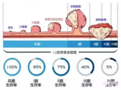 “无症状”是大肠癌的隐身衣——一旦出现症状，往往已是中晚期！40岁前做个肠镜才能心安