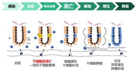 萎缩性胃炎，如何预防癌变？如何治疗？