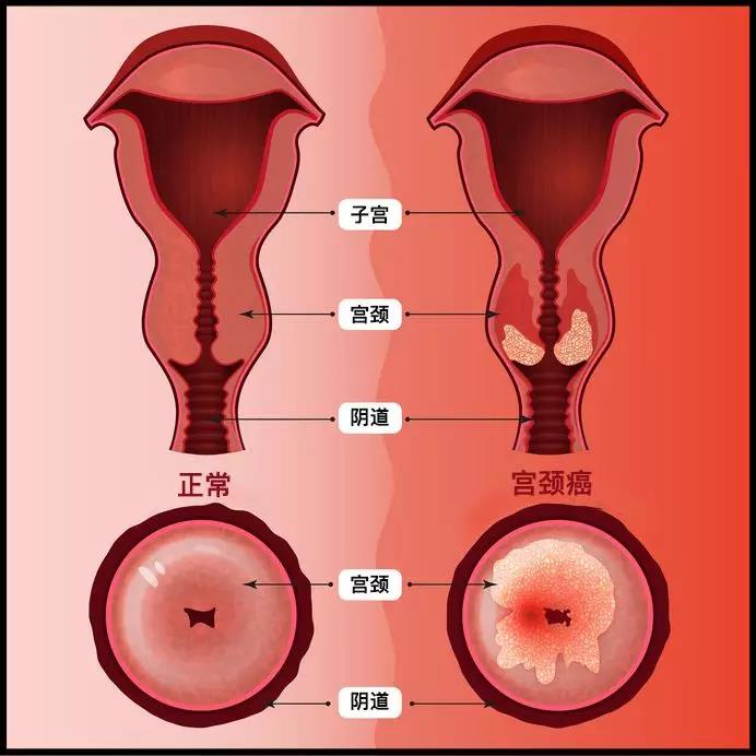 体检漏掉这些等于白做！各年龄段必检项目对照表转给所有人！