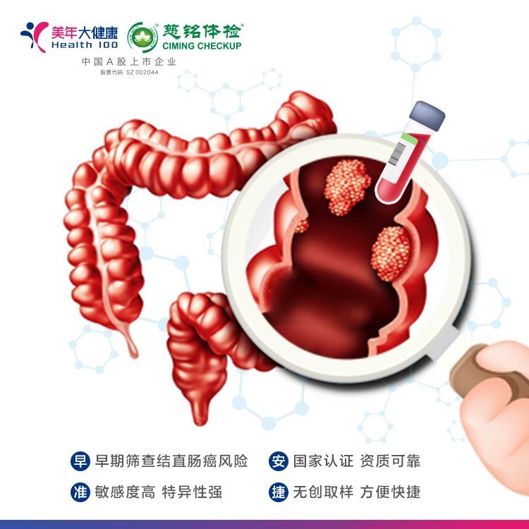 体检预约-S9结直肠癌无创早期筛查-金华美年大健康